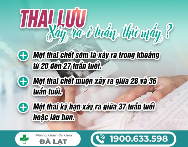 THAI LƯU THƯỜNG XẢY RA Ở TUẦN THỨ MẤY CỦA THAI KỲ?