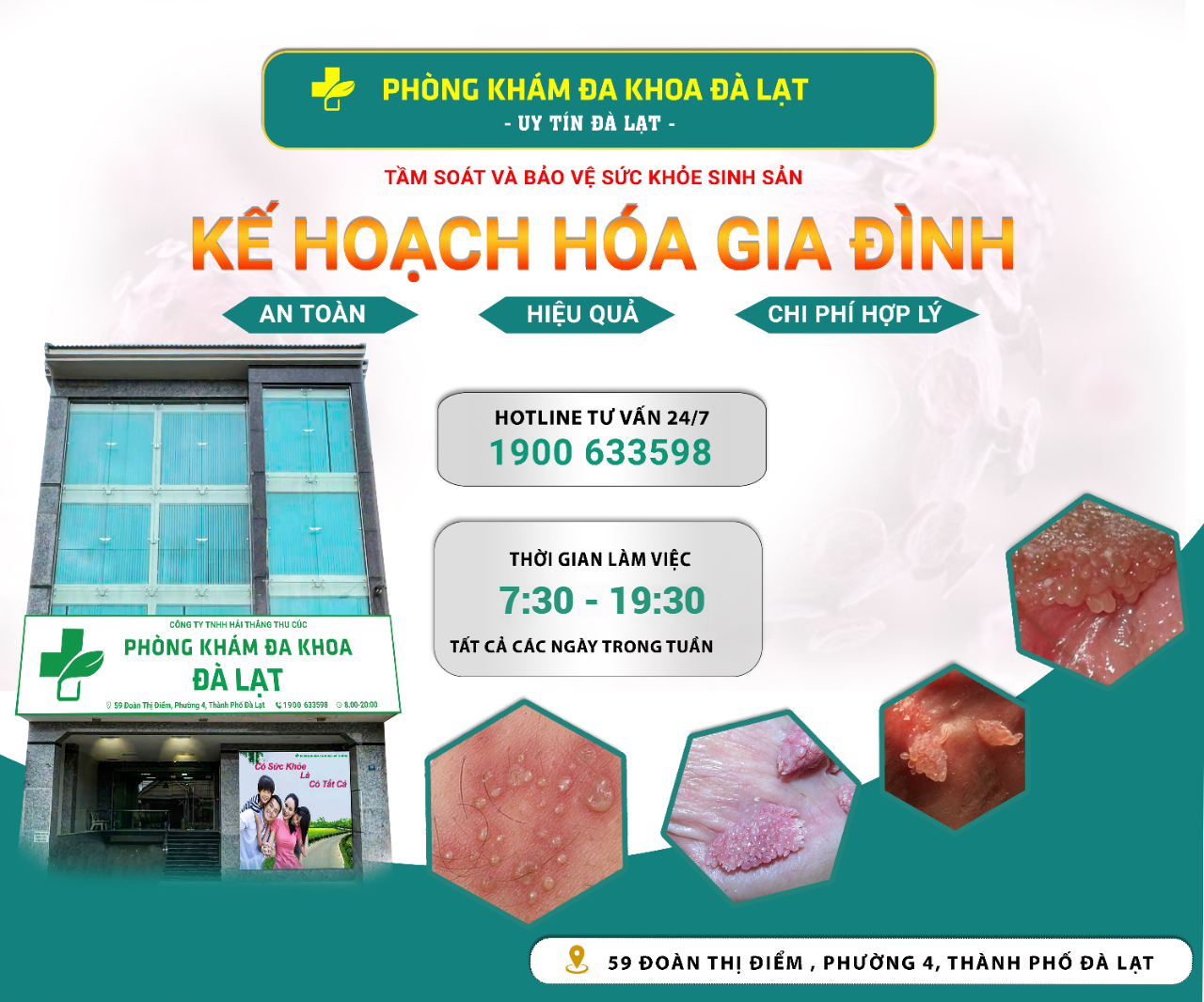 ĐỊA CHỈ CẤY QUE TRÁNH THAI AN TOÀN, UY TÍN TẠI ĐÀ LẠT