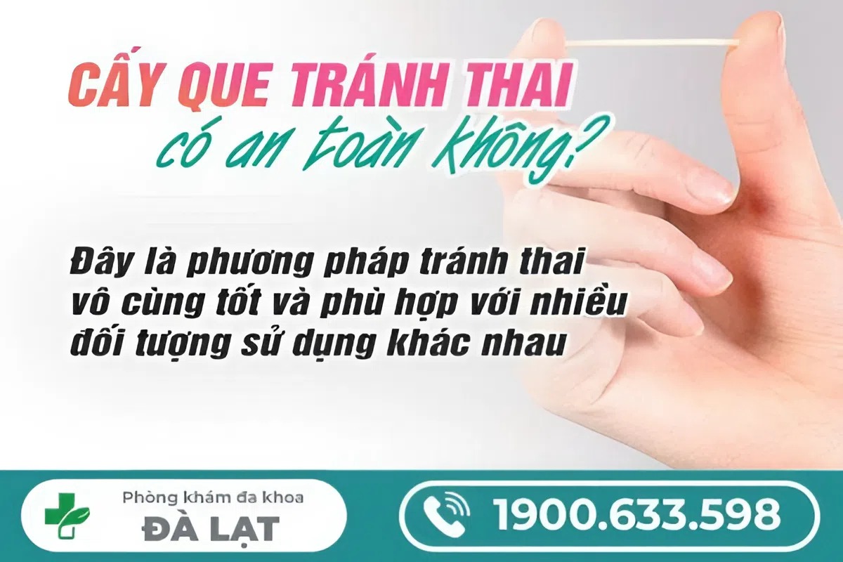 CẤY QUE TRÁNH THAI CÓ AN TOÀN KHÔNG?