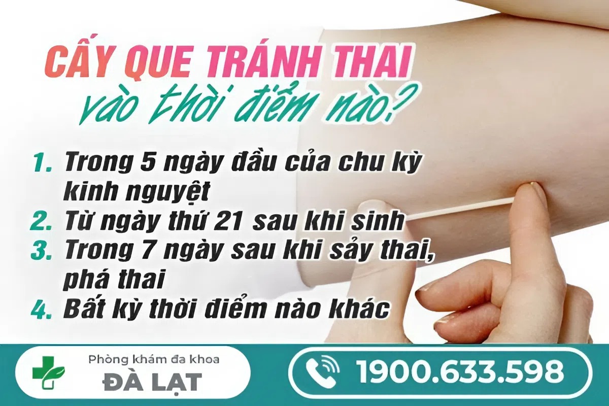CẤY QUE TRÁNH THAI VÀO THỜI ĐIỂM NÀO LÀ TỐT NHẤT?